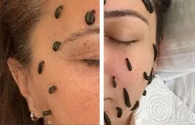 Hacamat seansı 7