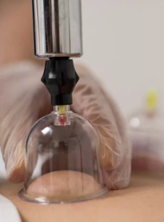 Ebusadullah Akademi Hacamat Eğitimi