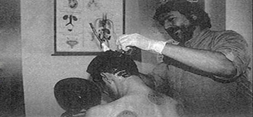 Ebusadullah Hoca hacamat seansı — arşiv 1990'lar